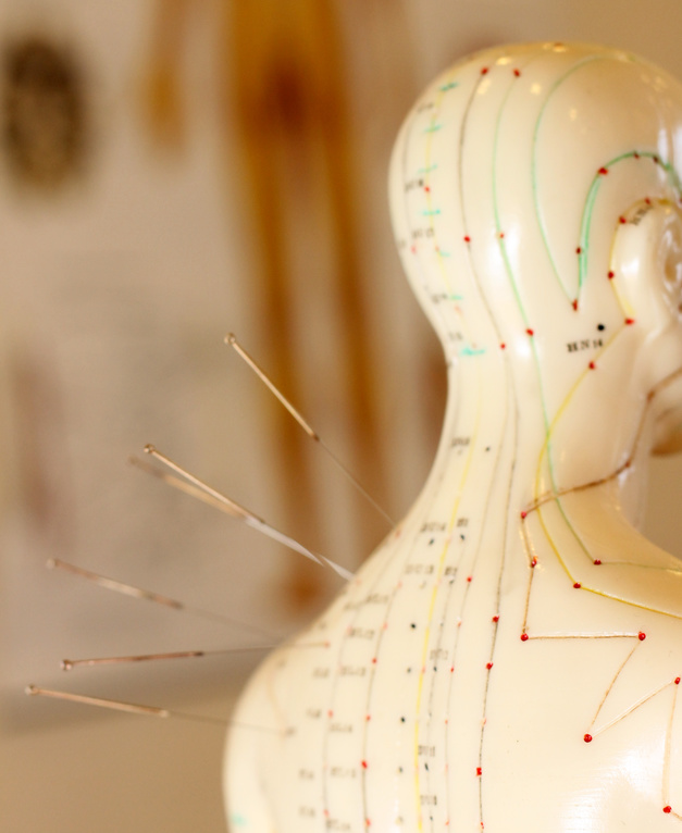 Meskipun cara kerja akupunktur tidak sepenuhnya dipahami di Barat