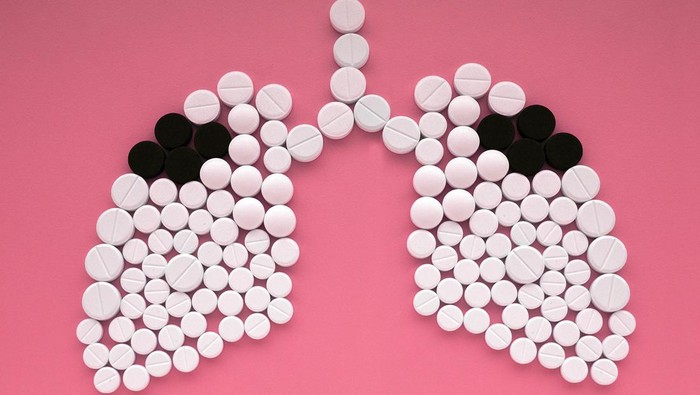 Kemenkes juga melakukan perbaikan deteksi dan pelaporan